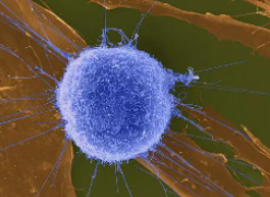 重编程免疫细胞的新方法显示在黑色素瘤中起作用