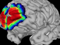 多级Julich大脑图谱可以帮助研究精神疾病和衰老障碍