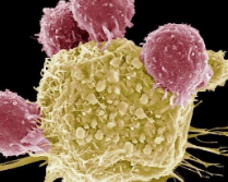 研究揭示了对导致肠癌的难以捉摸的端锚聚合酶蛋白的结构洞察