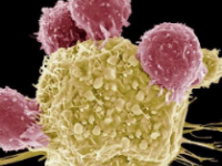 MYC蛋白形成空心球体保护癌细胞的基因组