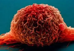 研究人员在缺氧条件下识别出少量作弊癌细胞