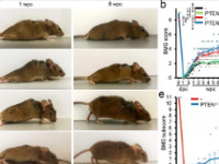 神经酰胺阻滞剂可防止小鼠衰老过程中肌肉质量的损失