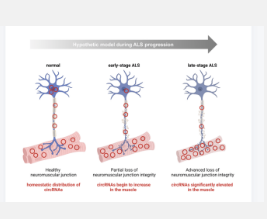 人类ALS骨骼肌的转录组学分析揭示了circRNA失调的疾病特异性模式