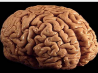 研究确定了人类大脑皮层回旋过度折叠的原因