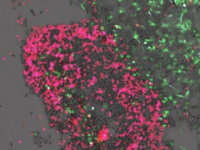 霍林斯研究人员开发小分子刺激自然杀伤细胞对抗神经母细胞瘤