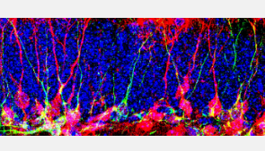 如何在大脑中产生新的神经元