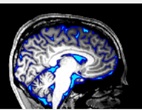 大脑中的流体流动可以通过感官刺激来控制