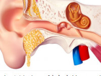 中耳炎的症状与治疗 中耳炎的症状