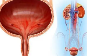 膀胱癌早期是什么症状