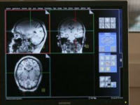 MRI成像方法在不施用放射性物质的情况下捕获脑葡萄糖代谢