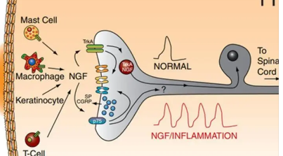 基因Tiam1协调慢性神经性疼痛的发展