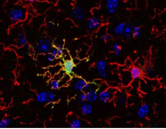 大脑的免疫细胞并不完全相同新研究可能开辟新的治疗途径