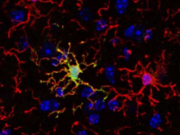 大脑的免疫细胞并不完全相同新研究可能开辟新的治疗途径