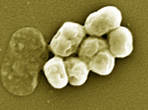 研究人员称旧抗生素对高度耐药的革兰氏阴性菌有效