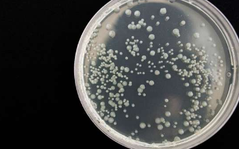 新测试方法可在五分钟内检测细菌是否对抗生素有反应