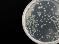 新测试方法可在五分钟内检测细菌是否对抗生素有反应