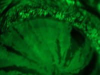 角膜损伤治疗可能源于识别可能成为治疗靶点的基因和蛋白质的研究
