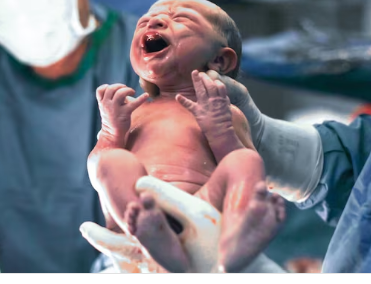 加压素对于氧气不足的新生儿来说是一种有效的治疗方法
