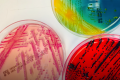 算法从临床分离物中鉴定出数十种新细菌物种