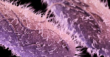 研究揭示了一些细菌感染如何变成慢性