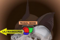 蝙蝠鼻骨形态的变化可确定超声定位