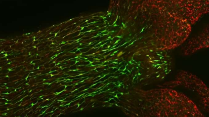 科学家通过用新型抗体对神经细胞进行着色来观察神经元刺激传递